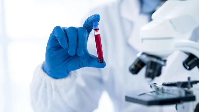 A hand in a blue nitrile glove holds a vial of blood, with a microscope in the background.  