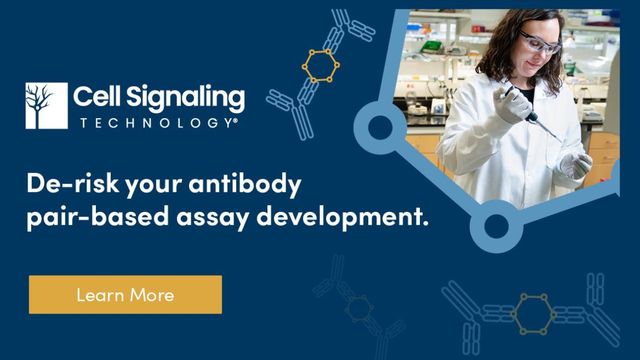 Scientist pipetting in lab beside text reading “De-risk your antibody pair-based assay development – Learn More. 