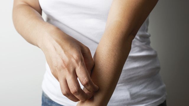 Person scratching forearm, illustrating skin irritation linked to toxic epidermal necrolysis. 