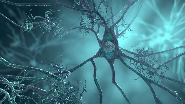 Digital illustration of damaged neurons representing neurodegeneration in the brain. 