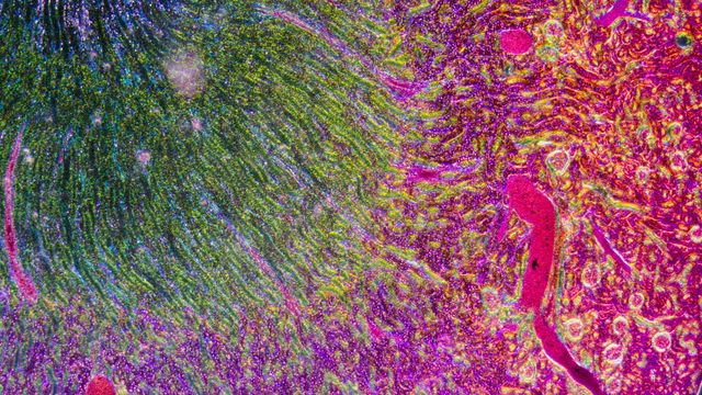 Microscopic view of kidney tissue stained pink and green. 