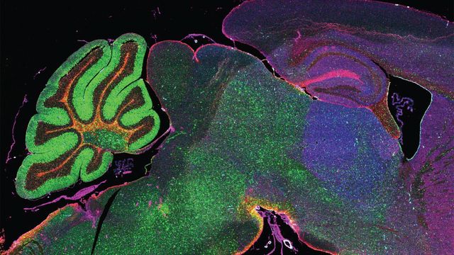 Fluorescent microscope image of a mouse brain section showcasing spatial biomarkers highlighting various anatomical structures  
