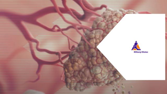 3D illustration of a tumor with branching blood vessels, used in single-cell sequencing research with Miltenyi logo. 